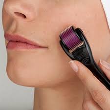 Rodillo Microagujas Dermaroller – Tratamiento Facial y Corporal para Rejuvenecimiento, Cicatrices y Estrías